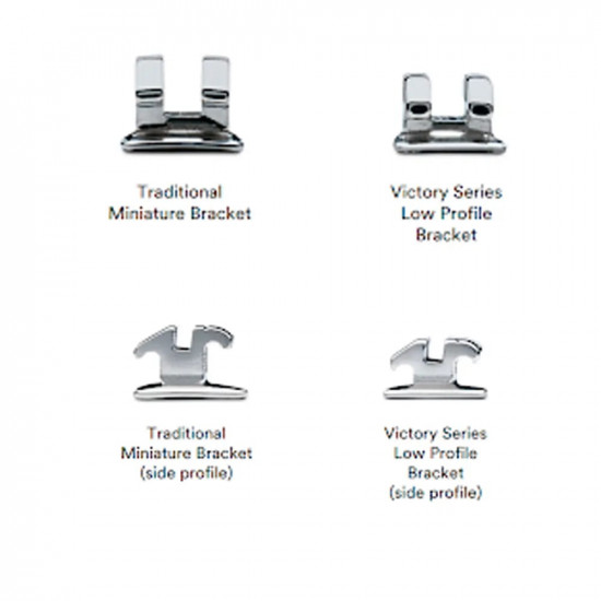 3M Unitek Victory Series Low Profile Brackets